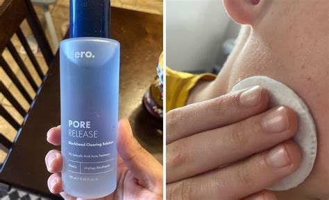 Unplug Your Gunky Pores with Hero Cosmetics Pore Release!.